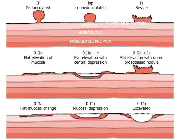 Lesion skin excision margin size mbs item biopsy items closure billing diameter defect medicare education under guide cancer melanoma length