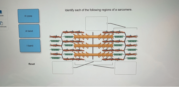 Sarcomere striated myosin filaments components actin micrograph disc electron proteins contribute