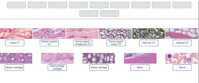 Muscle tissue drawing skeletal types anatomy cell biology muscular cells smooth human body cardiac diagram tissues functions muscles histology fibers